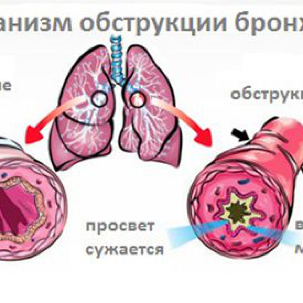 Как оттереть масляную краску с джинсов в домашних условиях Как оттереть масляную краску с джинсов в домашних условиях