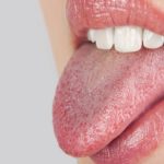 Сухость во рту - один из признаков побочного действия препарата