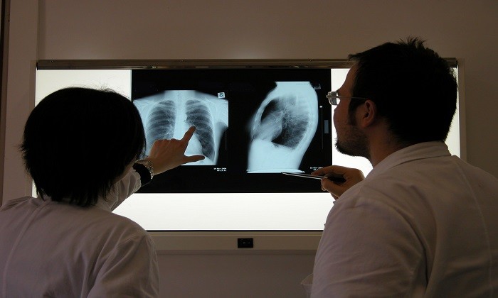 Чтобы исключить воспаление легких, больного направляют на рентген