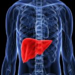 Передозировка препаратом может повлечь токсическое поражение печени