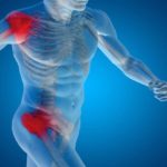 При артралгии принимают парацетамол