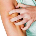 Аллергия, зуд и высыпания на кожных покровах, бронхиальные спазмы, крапивница - один из побочных эффектов на прием препарата