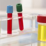 При длительном лечении рекомендуется контролировать функции печени и почек посредством анализов мочи и крови