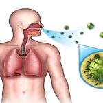 При инфекционно-воспалительных болезнях дыхательной системы врач назначает данное лекарственное средство