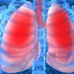 При заболеваниях лёгких нельзя применять небулайзер