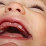 Обструктивный бронхит у ребенка вызывается прорезыванием зубов. Прорезывание зубов требует больших энергозатрат, что негативно сказывается на состоянии иммунитета