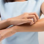 При применении Изопринозина возможны следующие нежелательные эффекты: изменения со стороны кожи, зуд