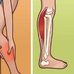 Судорога - это первый признак передозировки препарата