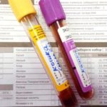 Для диагностики пылевого бронхита больной сдает общий анализ крови