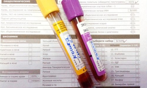 Стандартный анализ крови показывает изменения лейкоцитарной формулы и другие значения, говорящие о воспалительном процессе в организме
