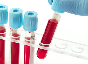 Расшифровка и показатели общего анализа крови при бронхите