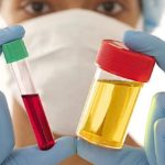 Анализы крови и мочи важны для исследования на наличие бронхита