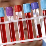 В период терапии лекарством пациенту следует обеспечить контроль состава периферической крови и работы почек/печени