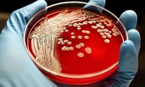 Лечение будет наиболее эффективным, если антибиотик назначают после проведения бактериального посева мокроты