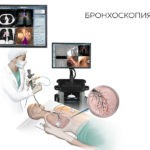 Для проведения дифференциальной диагностики пациенту рекомендуют бронхоскопию. С ее помощью устанавливают, насколько изменена слизистая оболочка бронхов