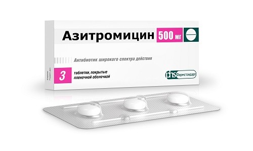 Азитромицин — это современный тип антибиотика, который используется как при остром, так и хроническом течении заболевания