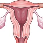 Причиной бронхита у беременных может стать растущая матка, которая давит на диафрагму, в связи с чем ухудшается вентиляция легких