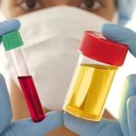 Чтобы подтвердить диагноз, назначают общий анализ крови и мочи