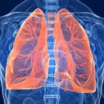 Препарат применяется при воспалении легких