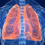 Пневмония является показанием для применения препарата