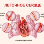 Данная патология встречается только у взрослых больных. Она характеризуется нарушениями в функционировании сердечно-сосудистой системы