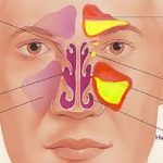 Антибиотик предназначен для лечения гайморита