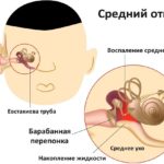 Клавам рекомендуют для лечения среднего отита