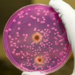 Острый бронхит диагностируют на основании лабораторного исследования посева мокроты