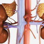 Лекарственное средство используется при поражении почек