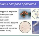 Причины возникновения острой формы обширны, но чаще имеют инфекционную этиологию. Возбудителями бывают как бактерии, так и вирусы