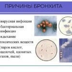 Хронический бронхит вызывают неблагоприятные факторы: производственная пыль, инфекции нижних дыхательных путей и др