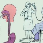 При передозировке лекарственным препаратом необходимо промыть желудок