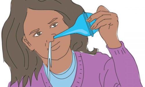 При наличии ринита, который часто сопровождает заболевание, важно промывать нос солевыми растворами, что предотвратит скапливание слизи в горле и избавит от приступов рвоты