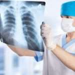 Проводится рентгенологическое исследование органов грудной клетки