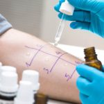 Обязательным методом диагностики заболевания является проба на аллергены