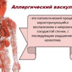 Прием Клавама может вызвать аллергический васкулит