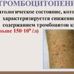 На фоне приема препарата могут возникнуть приступы тошноты и рвоты