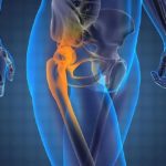 Действующий компонент медикамента снижает интенсивность суставных болей, минимизирует скованность суставов по утрам и устраняет отечность