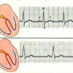 Прием Доксициклина может вызвать тахикардию